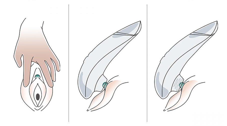L’utilisation du Womanizer